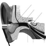 Lantos? earbuds are tailored to fit your ear canal.